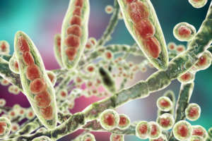 Dermatophyten - Trichophyton mentagrophytes